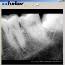 LK-C64 Ja Biotech Dental Röntgensensor Dental Digital